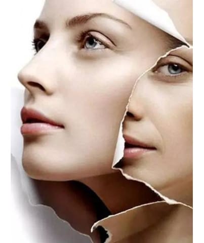 Cicalfate+ Anti Scar