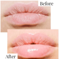 Hydra For Lips 10 Ml