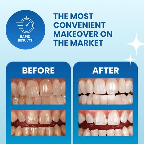 Oral B 3D Whitestrips Advanced